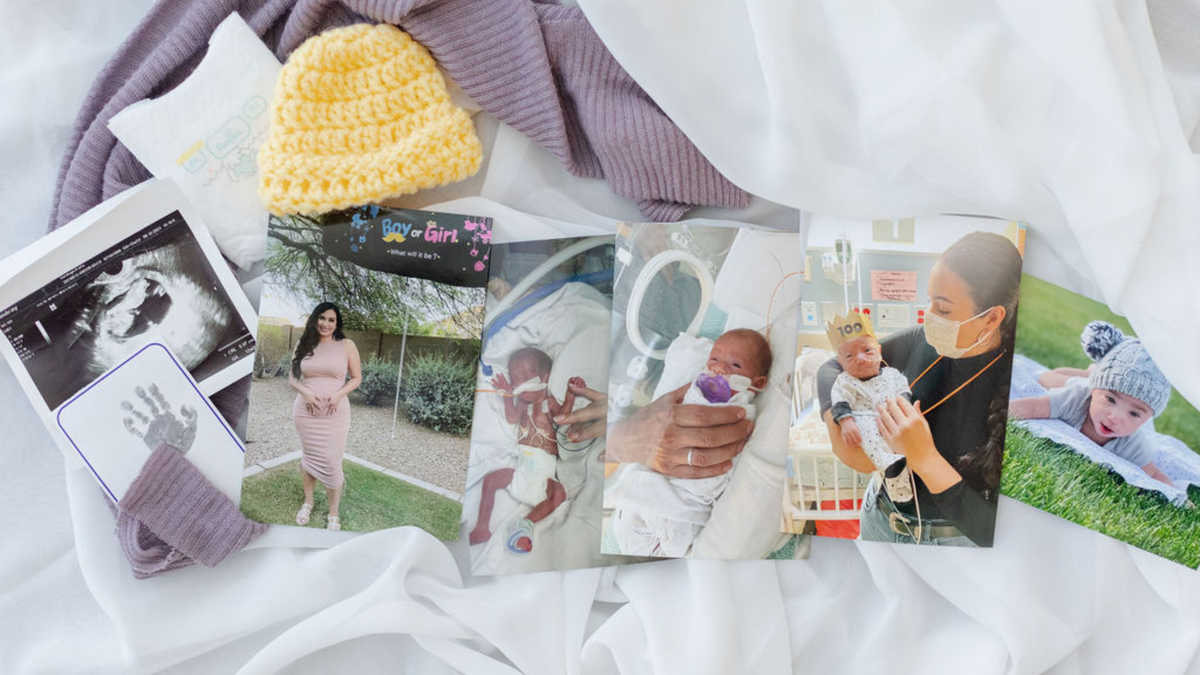 Benefits of a NICU Graduate Photoshoot, NICU photos, NICU Story